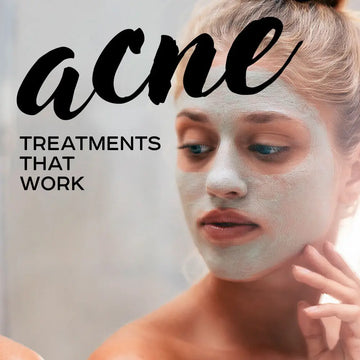 THE TRUTH ABOUT ACNE AND THE ACNE TREATMENTS TO HELP YOU