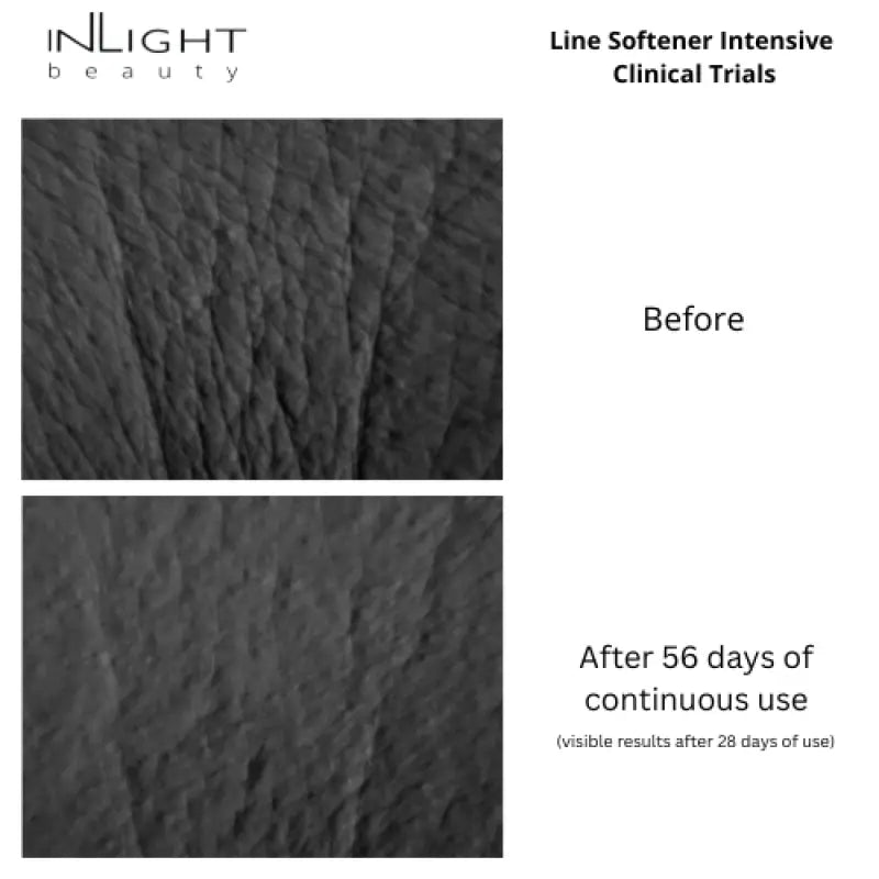 Lite Line Inlight Buy Inlight Beauty Line Softener Intensive 15ml online | Alyaka UK
